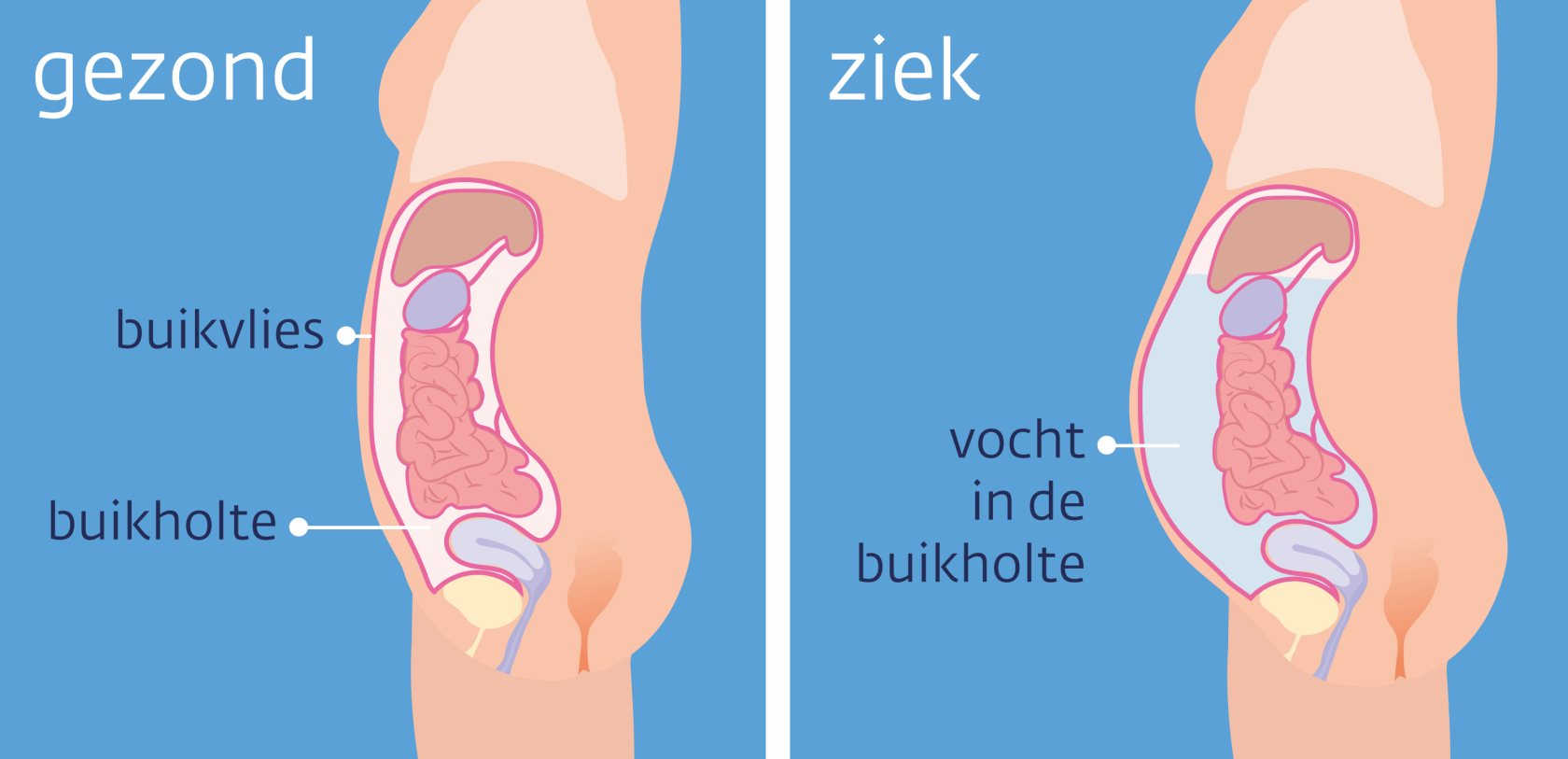 het vocht